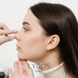 Rhinoplasty 37 Burun Estetiği Sonrası Burun Ucu Düşmemesi İçin Ne Yapılmalı
