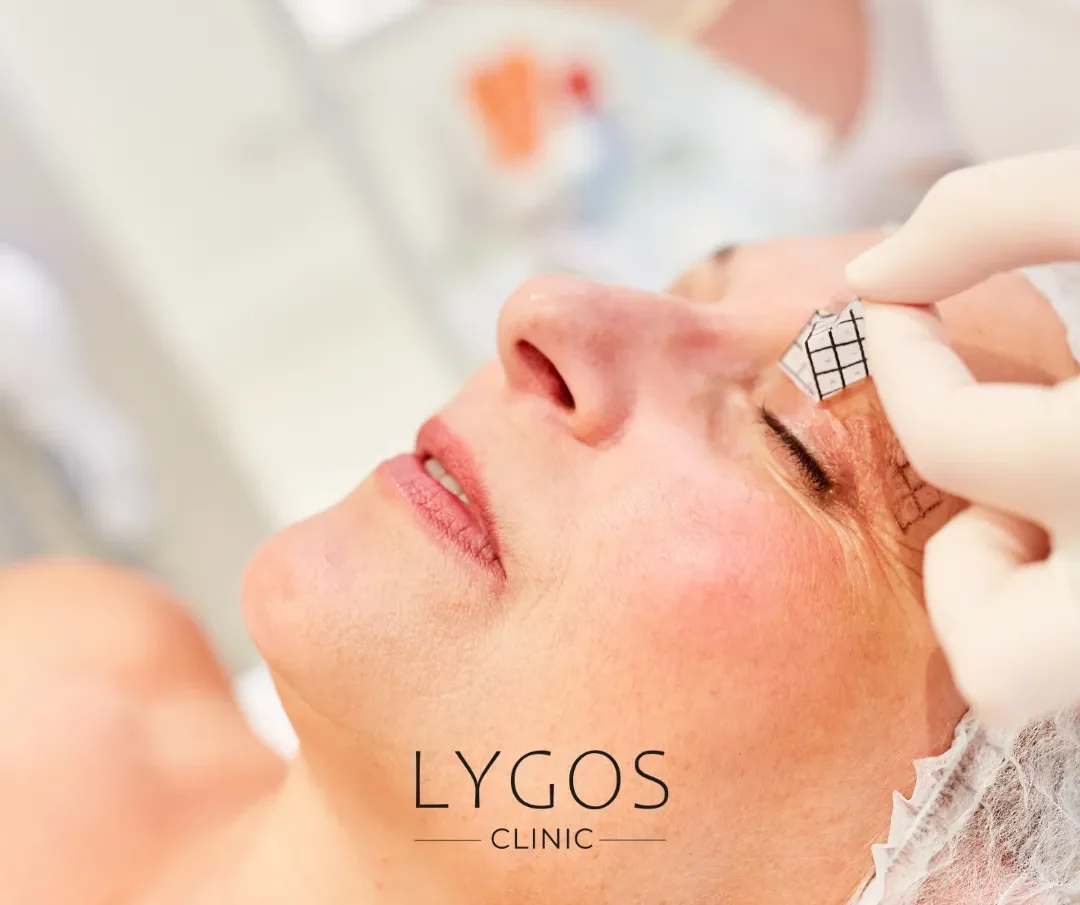 Eyelid Aesthetic 18 Göz Kapağı Estetiği Blefaroplasti Sonrası İyileşme
