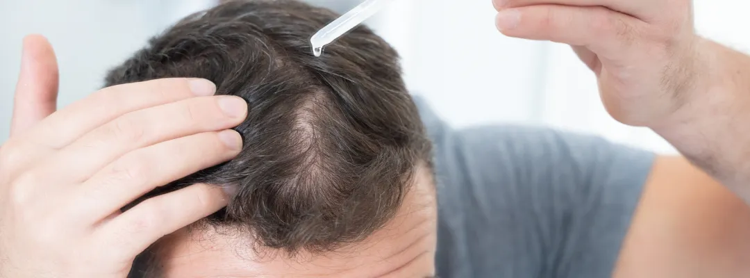 why does hair loss occur result