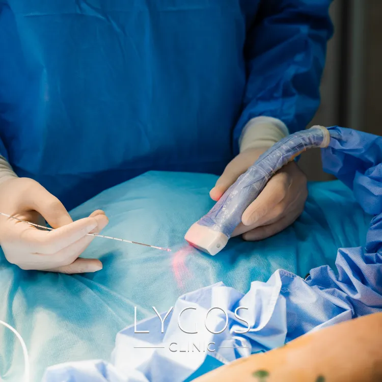 Capillary Treatment 13 Lazerle Kılcal Damar Tedavisi