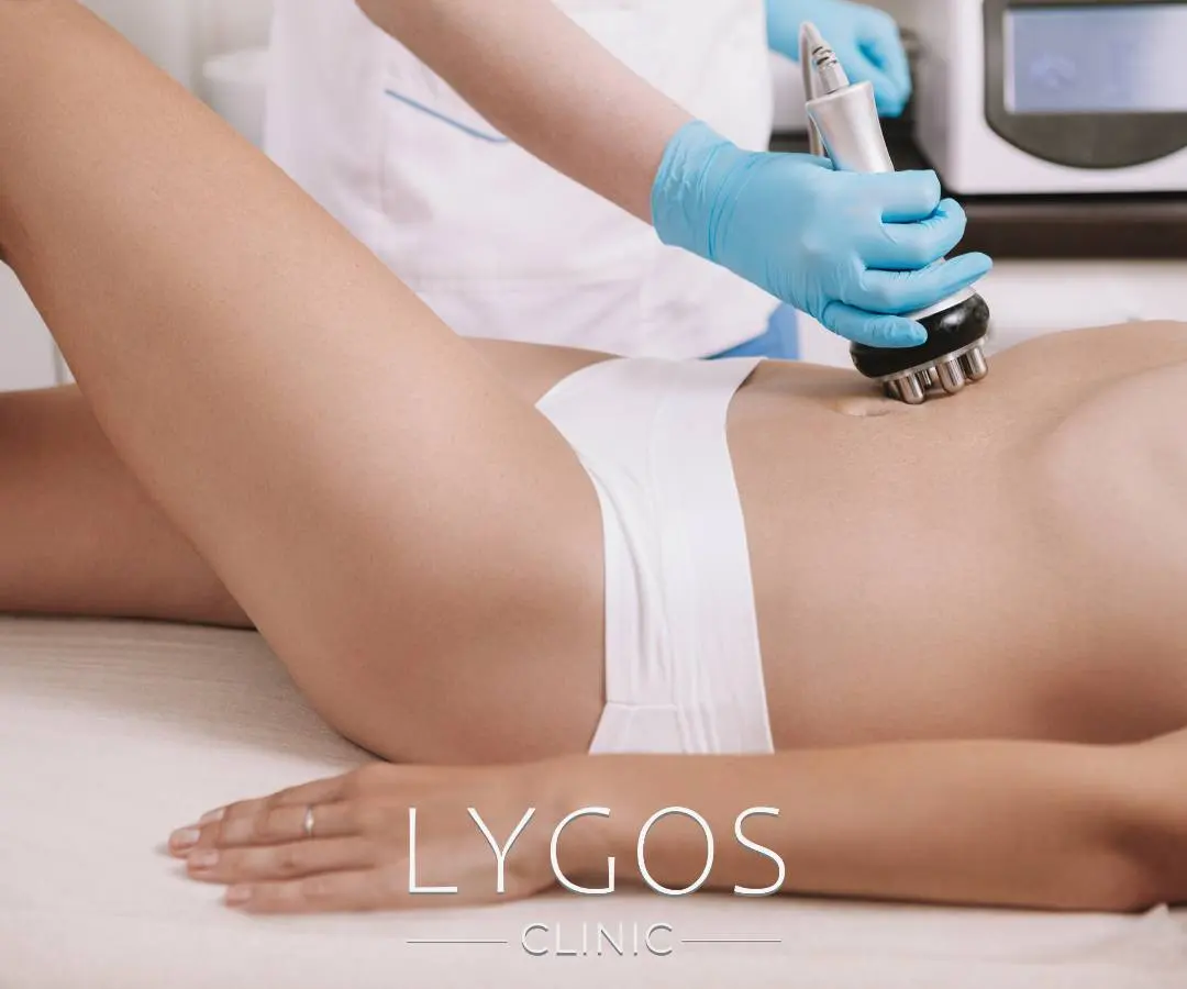 Radiofrequency Treatment 13 radiofrequency treatment
