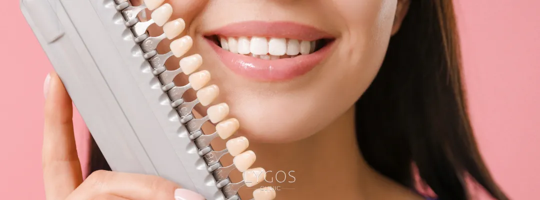 Advantages of Dental Veneers