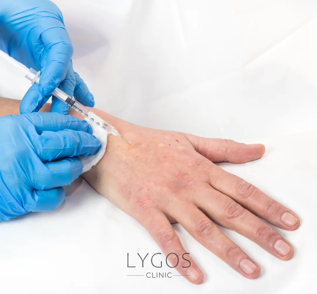 Hand Mesotherapy 11 El Mezoterapisi Nasıl Yapılır?