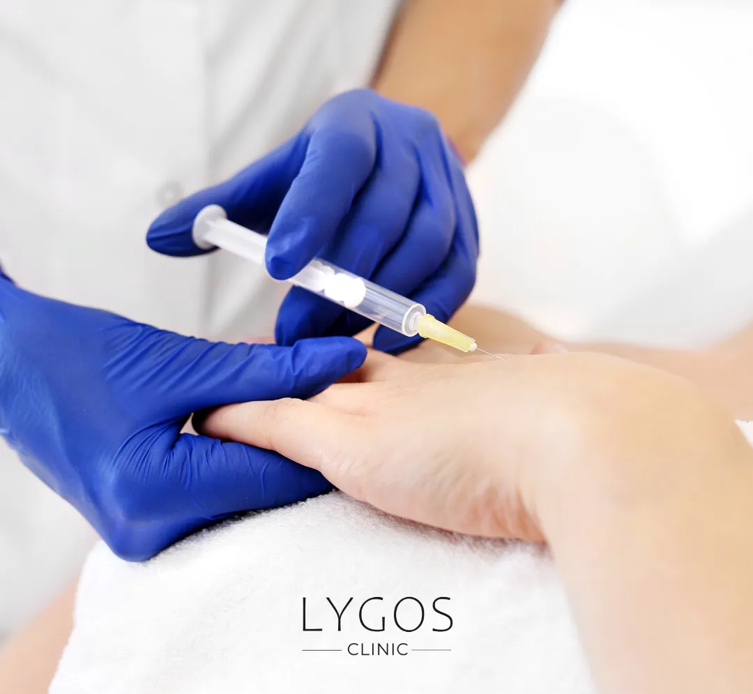 Hand Mesotherapy 10 El Mezoterapisi Nedir?