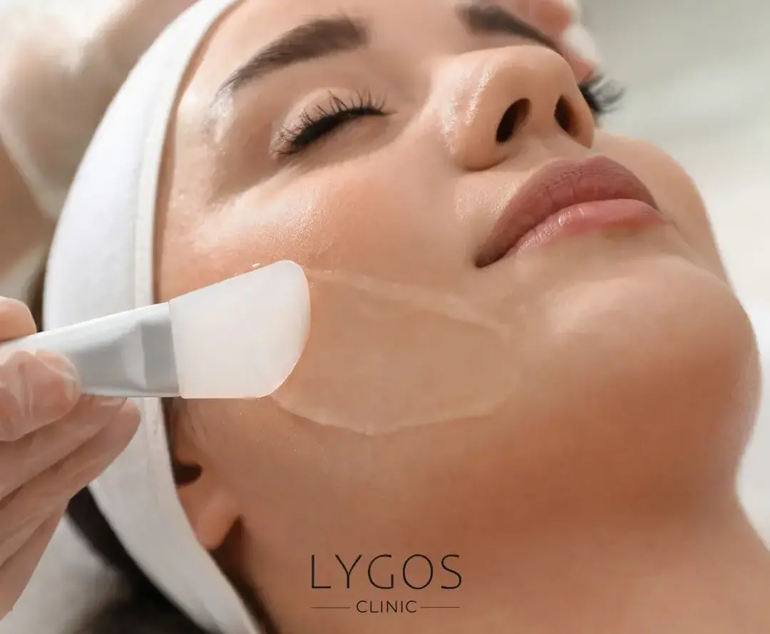 Chemical Peel 12 Kimyasal Peeling Zararları
