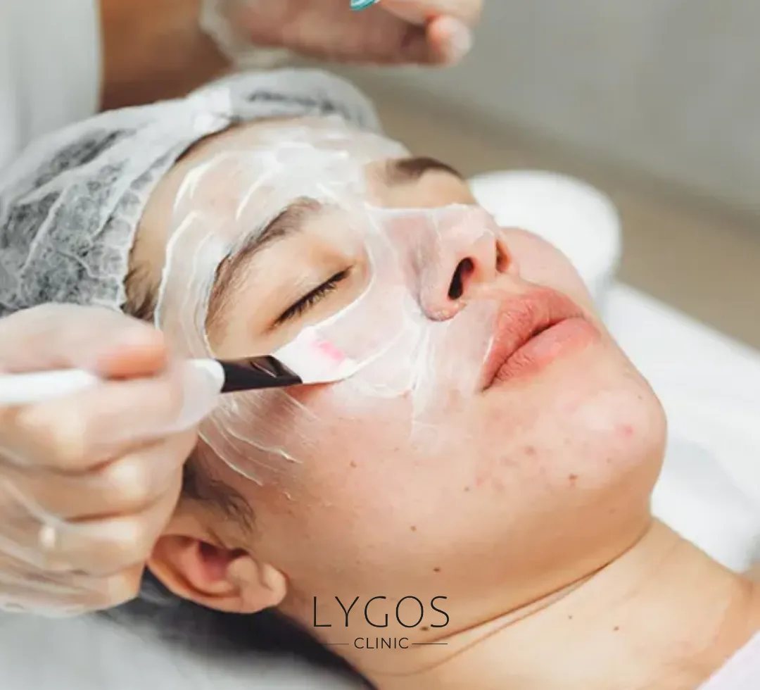 Chemical Peel 10 Kimyasal Peeling Nedir?