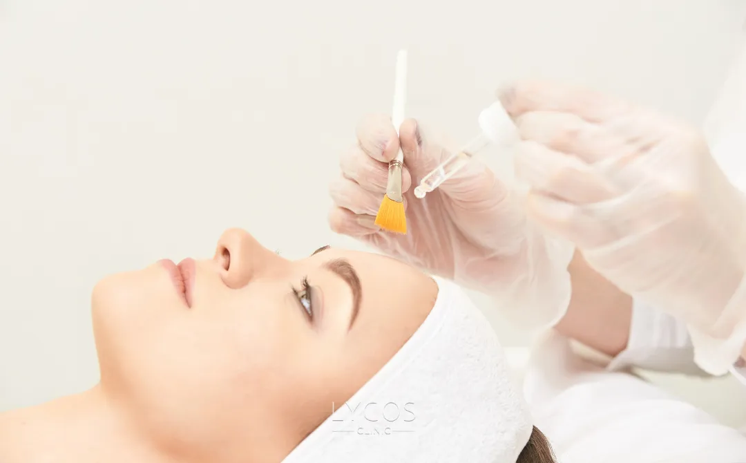 Chemical Peel 11 Kimyasal Peeling Zararları