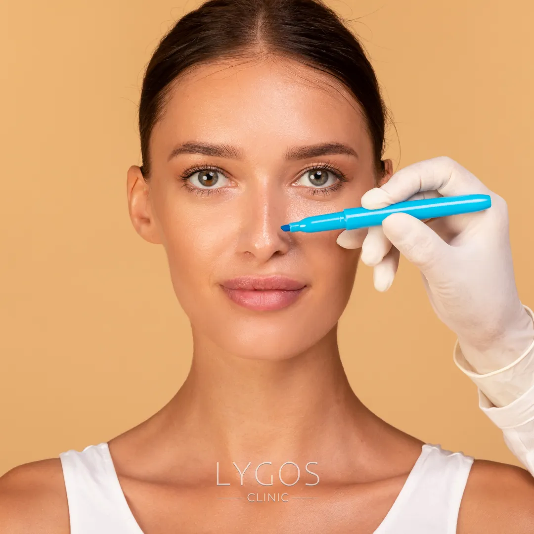 Non-Surgical Rhinoplasty | How to do it | LYGOS CLINIC 2025 1 Non-Surgical Rhinoplasty