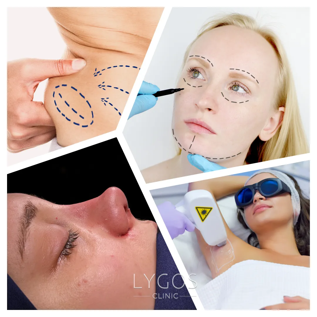 Plastic Surgery Results | Before and After | LYGOS 2025 1 Plastic Surgery Results Before After