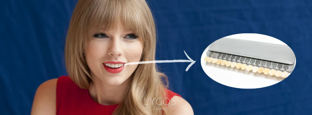 Taylor Swift Diş Kaplaması Yaptırdı mı?