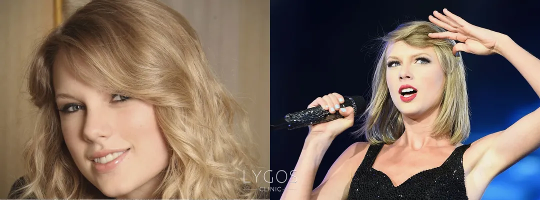 The Transformation of Taylor Swift's Teeth