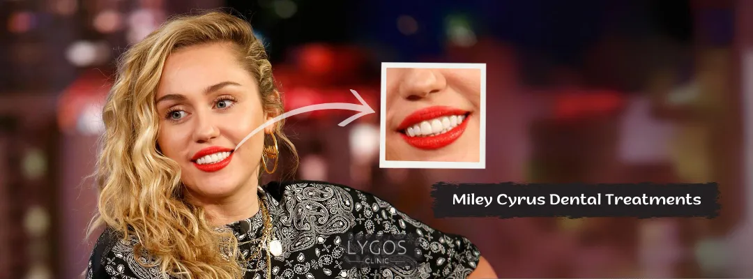 Miley Cyrus Dental Treatments