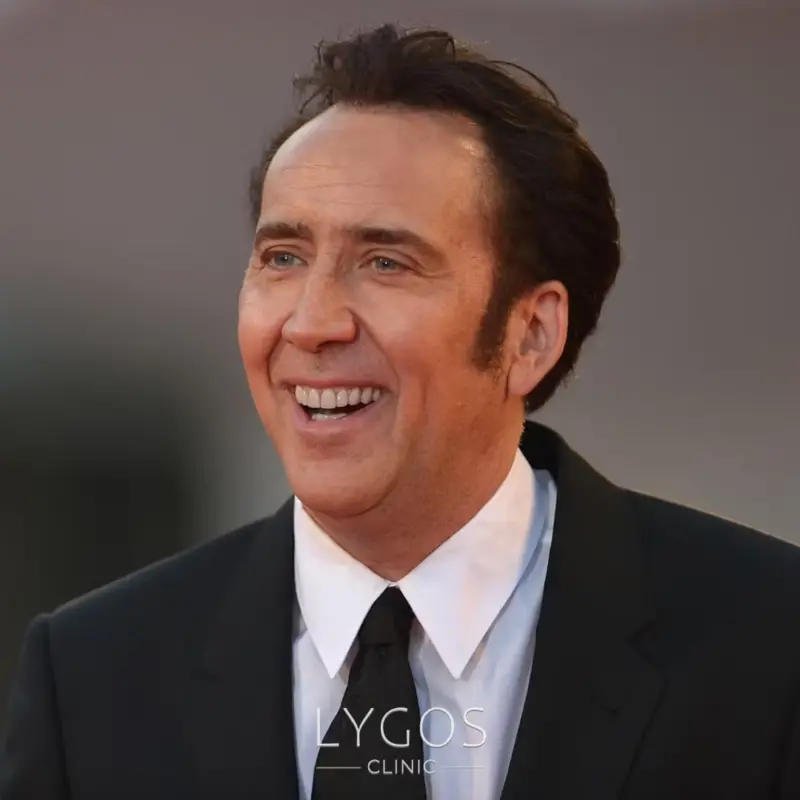 Nicolas Cages Teeth