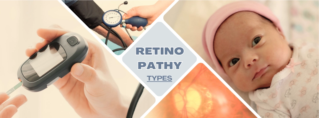 What are the Types of Retinopathy?