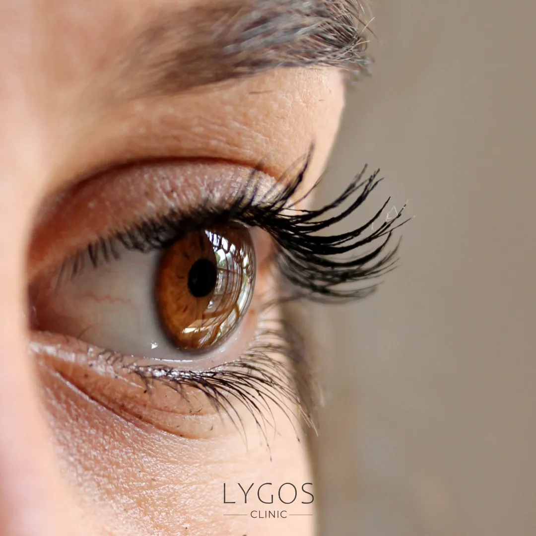 Eye Twitching | Eye Twitching Symptoms | LYGOS 2025 1 Eye Twitching