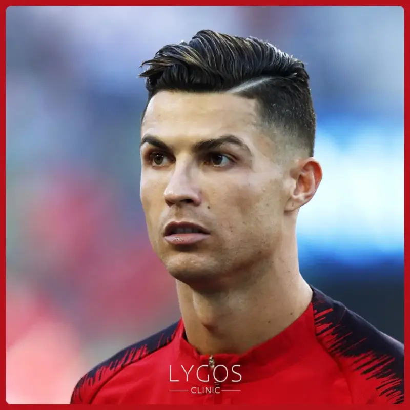 Did Cristiano Ronaldo Hair Transplant