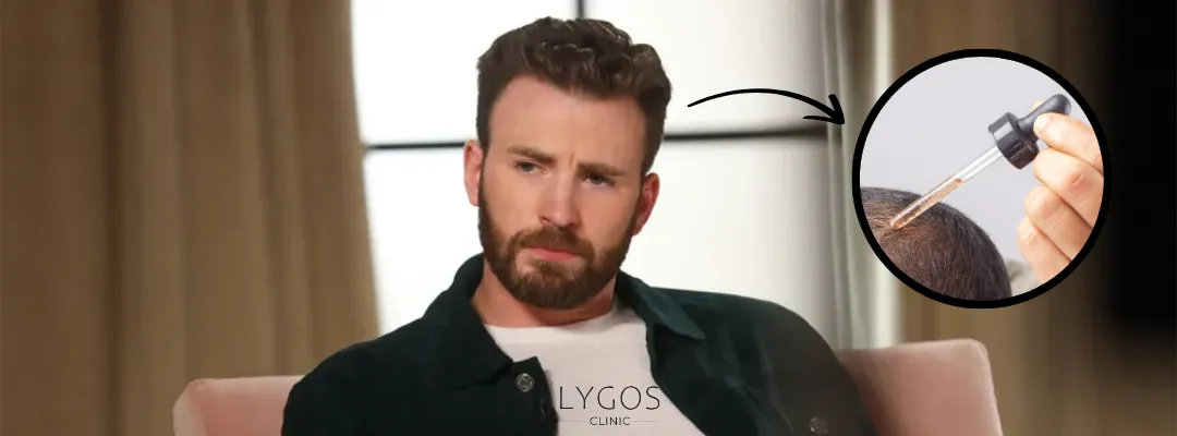 Has Chris Evans Had Hair Loss Treatment?