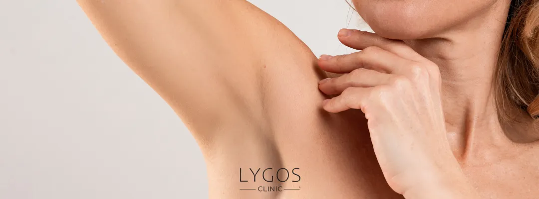 How Long Does Armpit Botox Last?