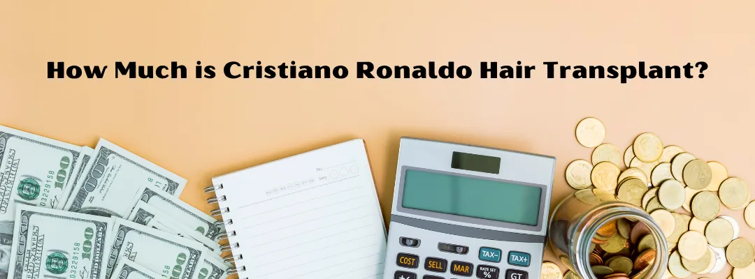 How Much is Cristiano Ronaldo Hair Transplant?