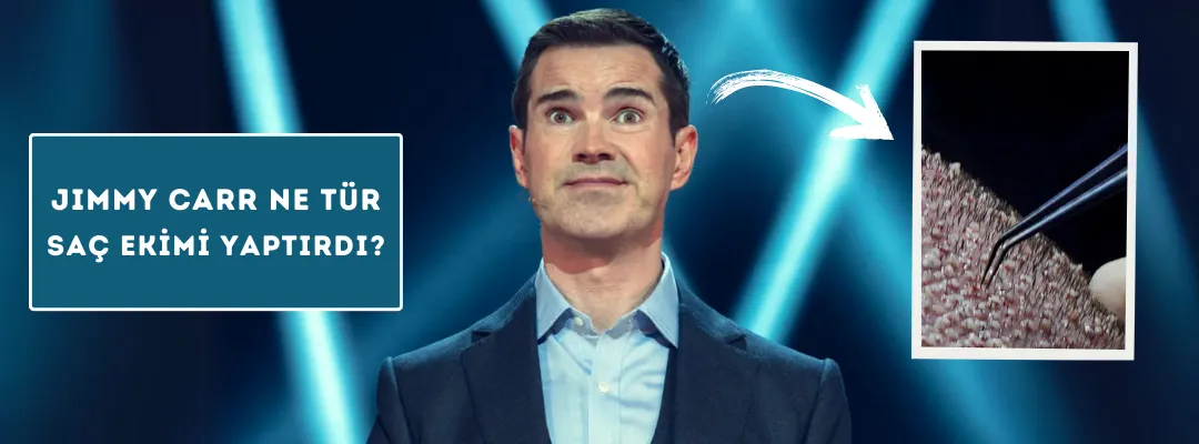 Jimmy Carr Ne Tür Saç Ekimi Yaptırdı?