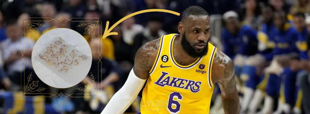 LeBron James’e Kaç Greft Saç Ekimi Yapıldı?