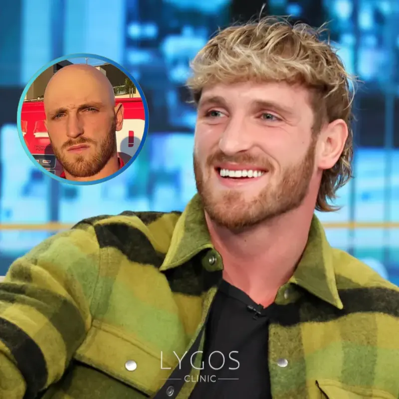 Logan Paul'un Saç Ekimi