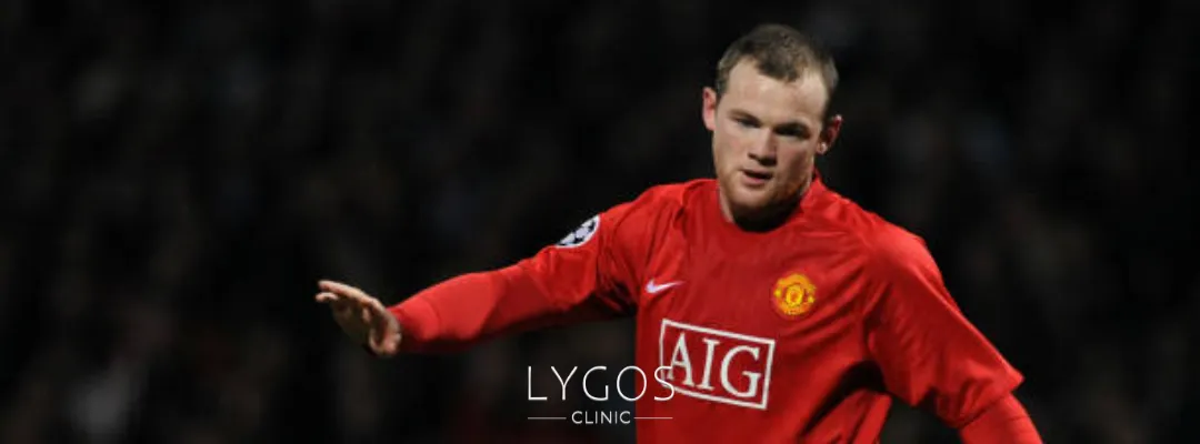 Wayne Rooney’nin Saçlarına Ne Oldu?