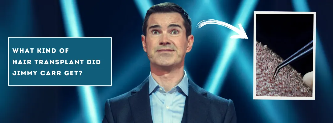 What Kind of Hair Transplant Did Jimmy Carr Get?