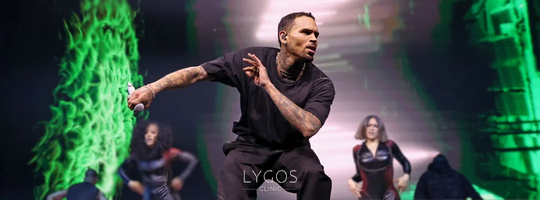 Chris Brown Saç Ekimi Yaptırdı mı?