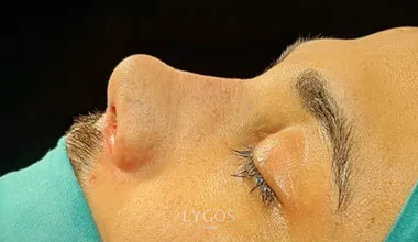 closed rhinoplasty landing