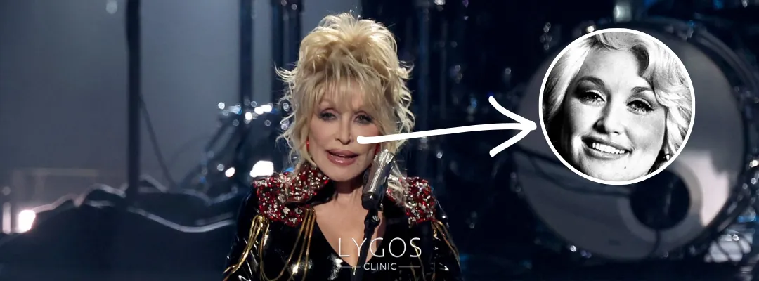 Did Dolly Parton Get A Nose Job?