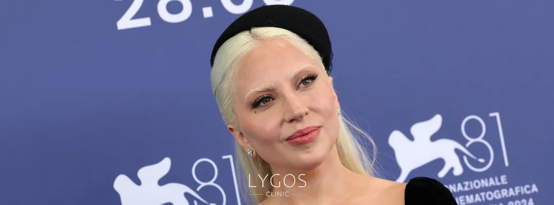 Did Lady Gaga Get A Nose Job?