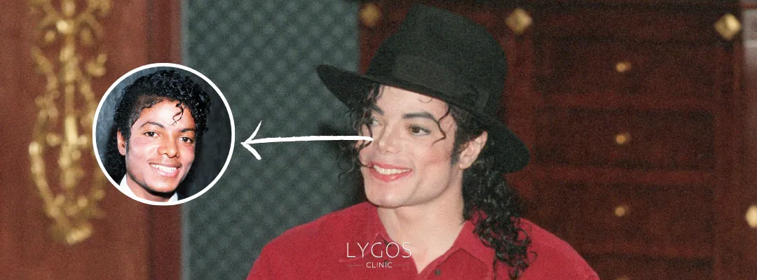 Did Michael Jackson Get A Nose Job?