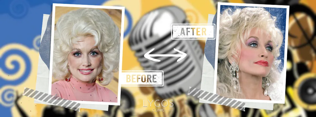 Dolly Parton Rhinoplasty Before and After