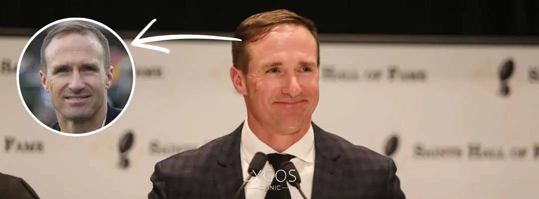 Drew Brees Hair Loss