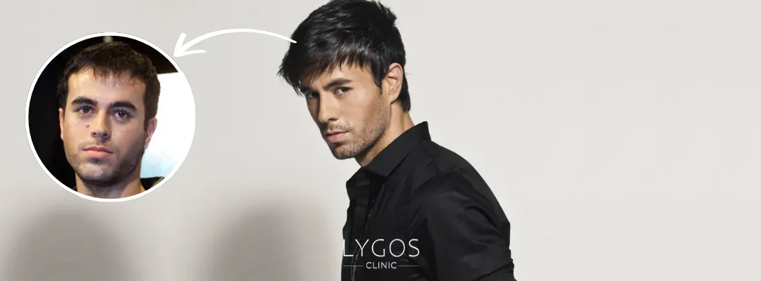 Enrique Iglesias Hair Loss