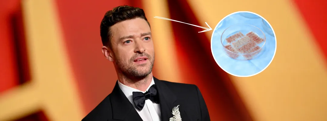 How Many Grafts of Hair Transplant Were Performed on Justin Timberlake?