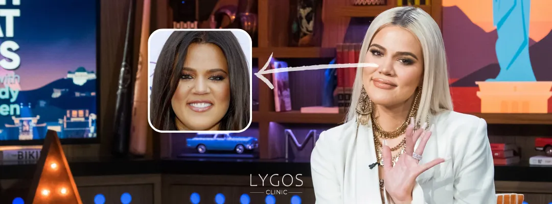 Khloe Kardashian Burun Estetiği Yaptırdı mı?