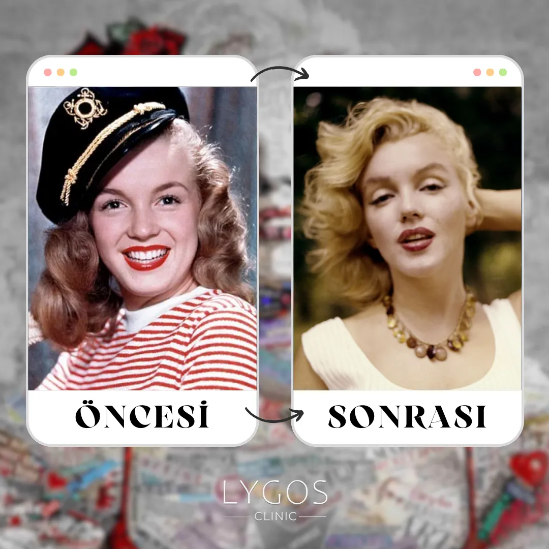 Marilyn Monroe Burun Estetiği | Ünlülerde Burun Estetiği 1 Marilyn Monroe Burun Estetiği