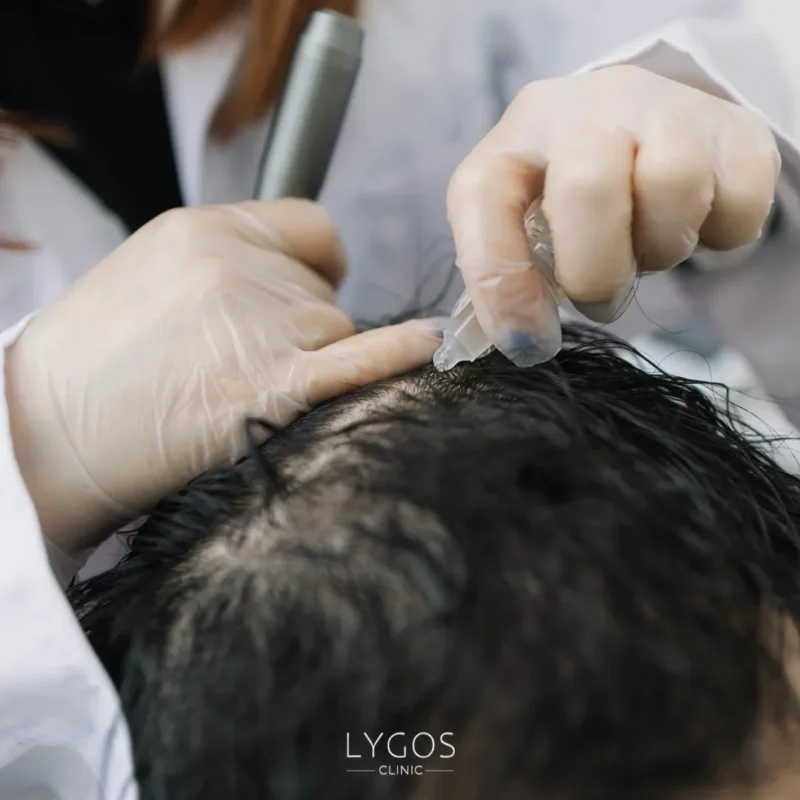 New Hair Regrowth Methods