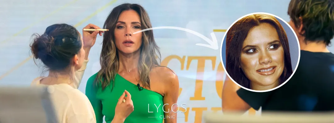 Victoria Beckham Burun Estetiği Yaptırdı mı?