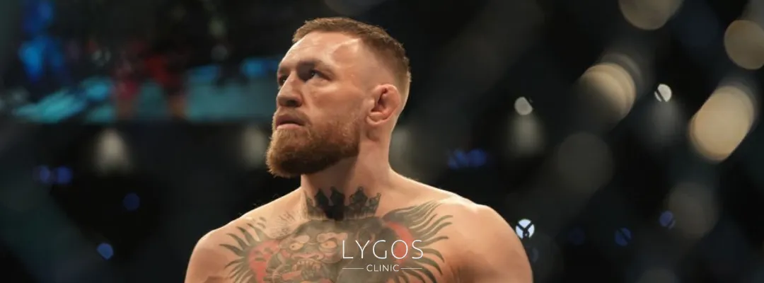 Who is Conor McGregor?