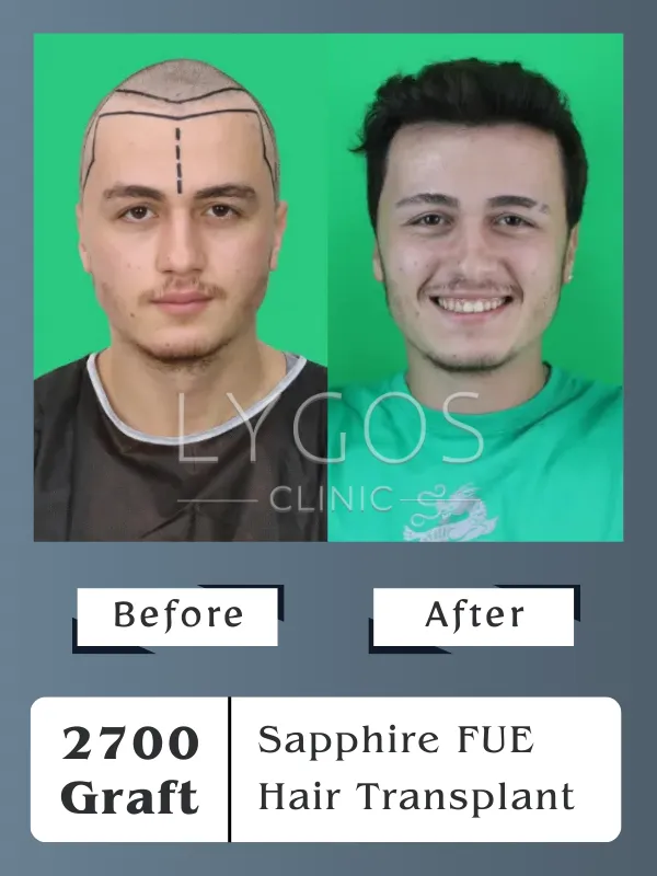 before-after-slider2nwi.webp