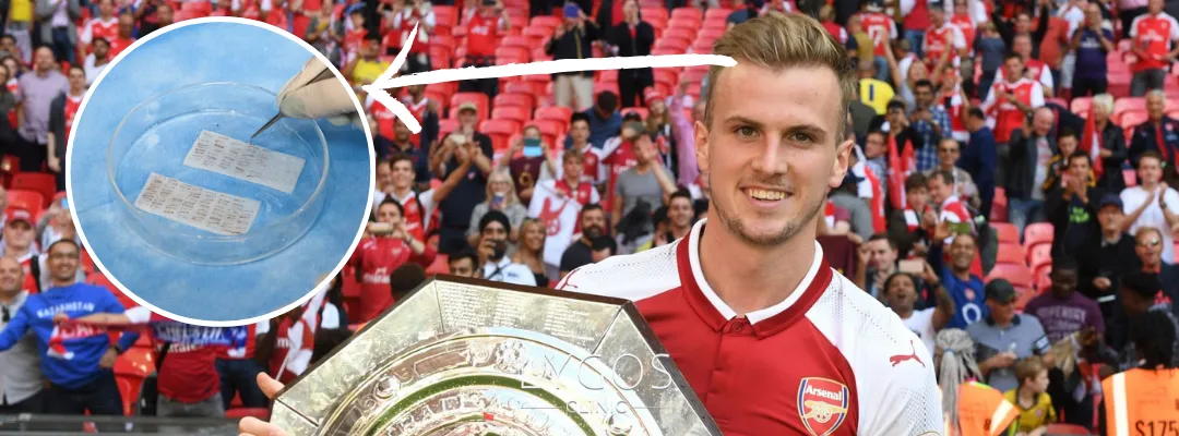 How Many Grafts of Hair Transplant Was Performed on Rob Holding?