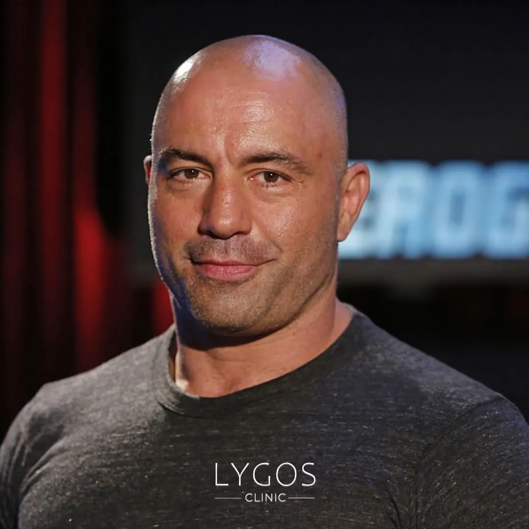 Joe Rogan Saç Ekimi | Ünlülerde Saç Ekimi 1 Joe Rogan Saç Ekimi