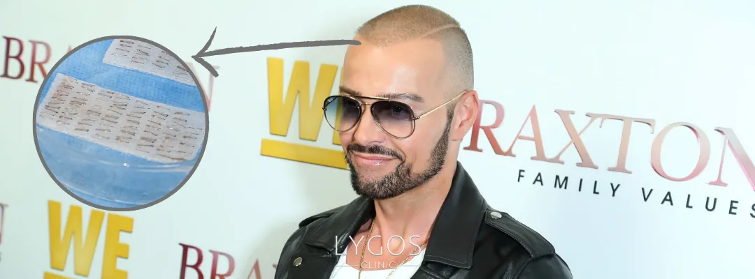 Joey Lawrence’a Kaç Greft Saç Ekimi Yapıldı?