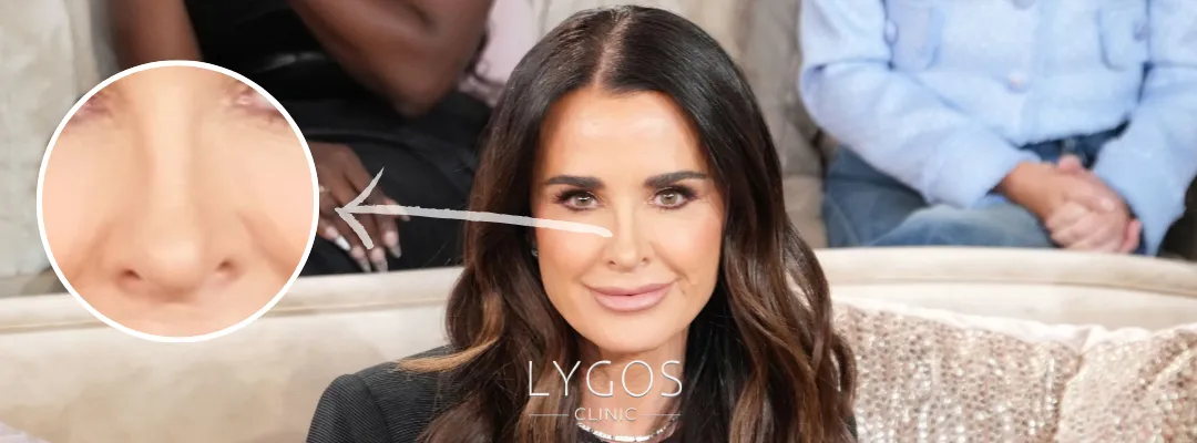 Kyle Richards Burun Estetiği | Ünlülerde Burun Estetiği 3 Kyle Richards Burun Estetiği Yaptırdı Mı?