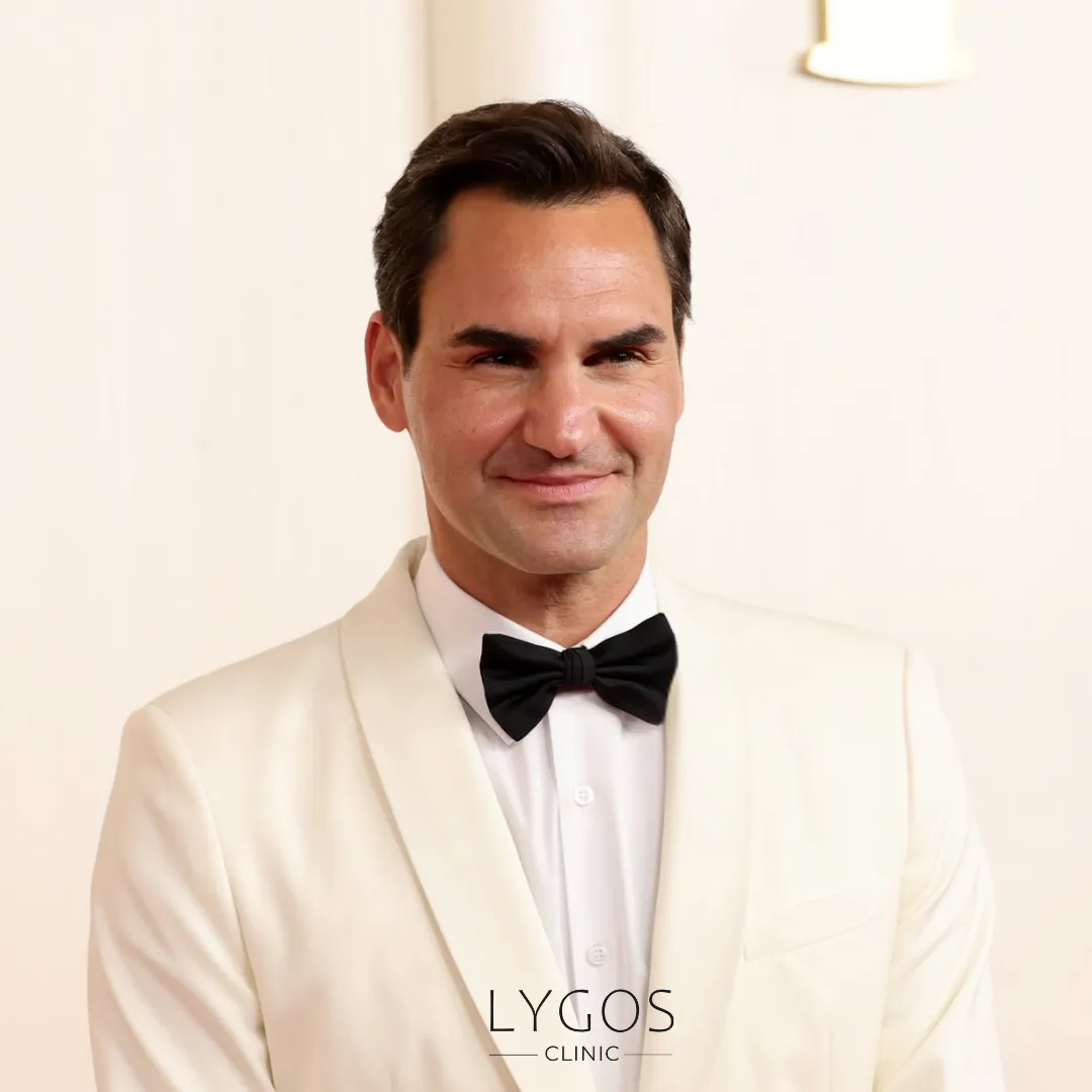 Roger Federer Hair Transplant | Celebrities Hair Transplant 1 Roger Federer Hair Transplant