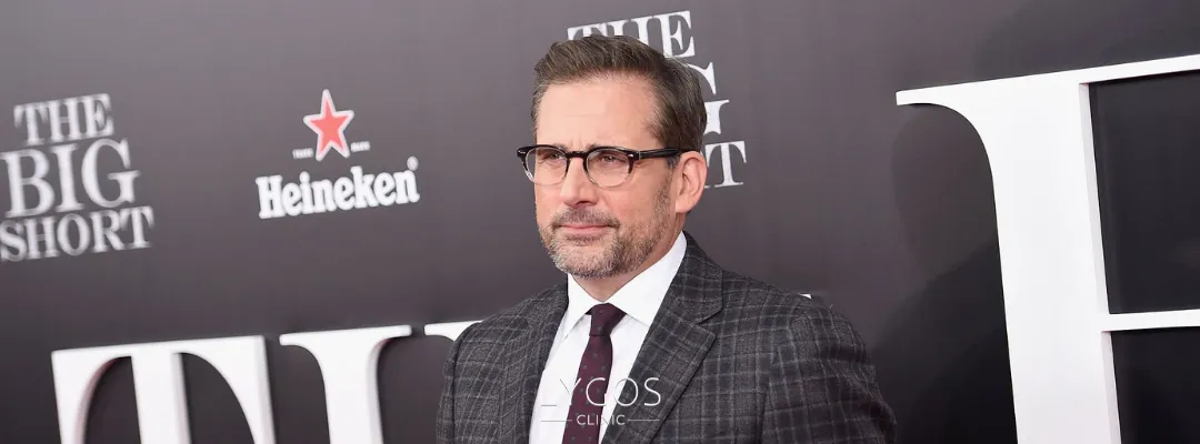 Steve Carell Saç Ekimi Yaptırdı mı?