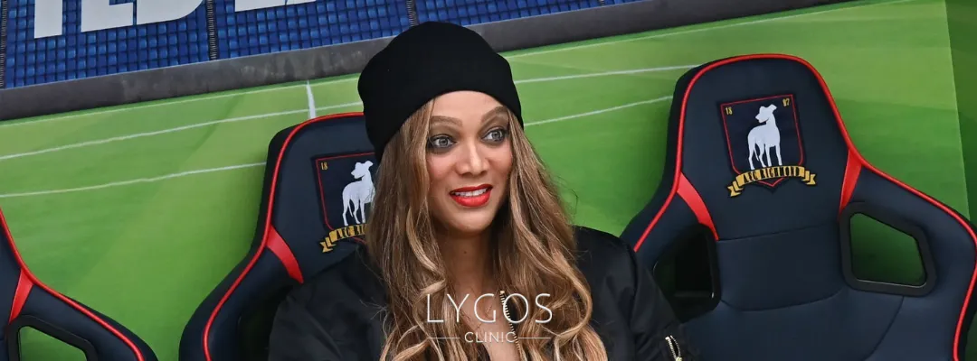 Ünlüler Neden Burun Estetiği Yaptırır? Tyra Banks
